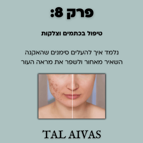 ⁦המדריך המהיר  לעור נקי וזוהר:איך להעלים אקנה וצלקות בקלות ובמהירות⁩ – תמונה ⁦10⁩